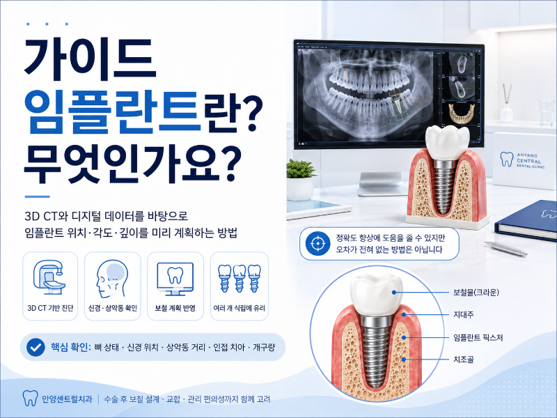 안양센트럴치과 가이드 임플란트 3D CT 진단 이미지