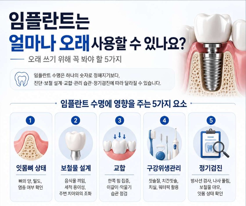 임플란트 수명
