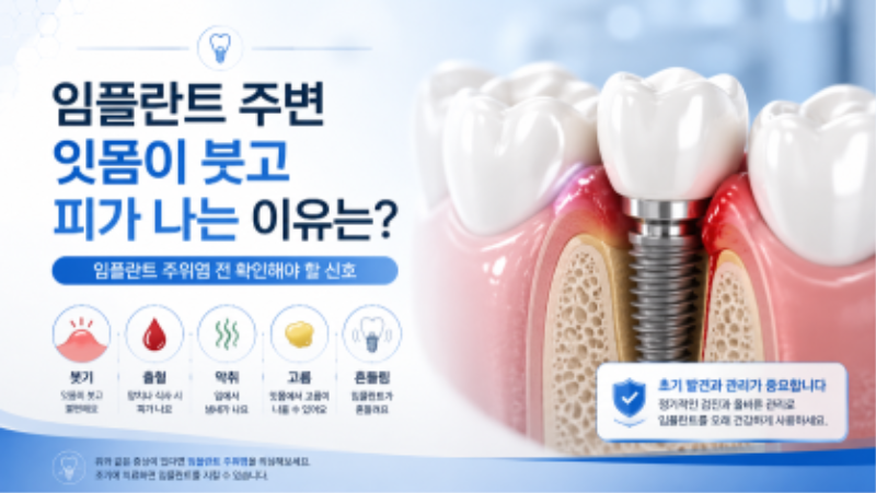 임플란트 주변 잇몸에서 피가나요(implant, peri-implantitis