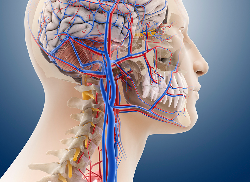 신경혈관성 치통