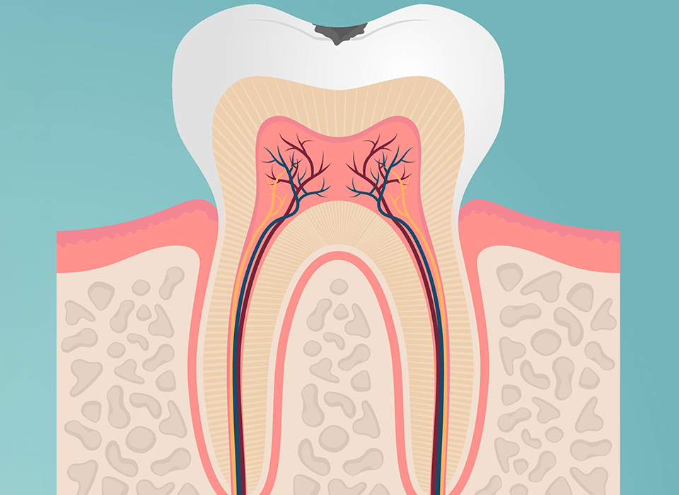 임플란트 부분틀니 임플란트 보철