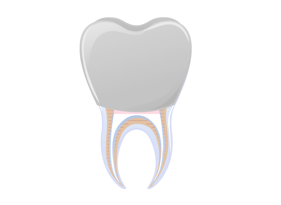 임플란트 부분틀니 임플란트 보철
